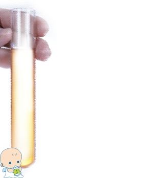 专家